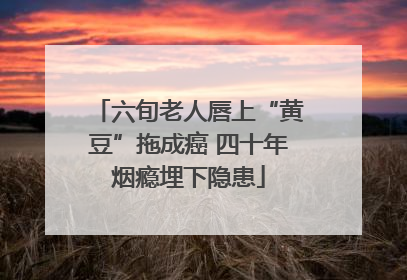 六旬老人唇上“黄豆”拖成癌 四十年烟瘾埋下隐患