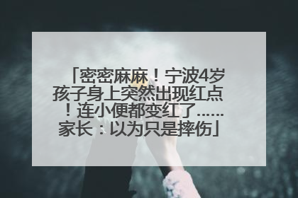 密密麻麻！宁波4岁孩子身上突然出现红点！连小便都变红了……家长：以为只是摔伤